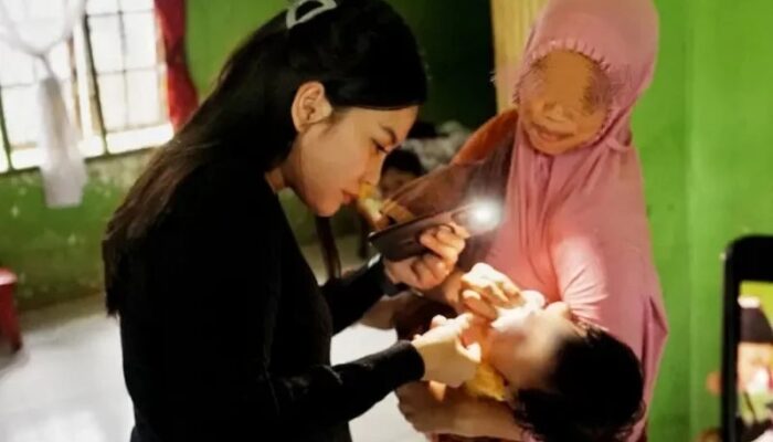 Bayi Sumbing di Medan Jalani Operasi Berkat Respons Cepat Wali Kota